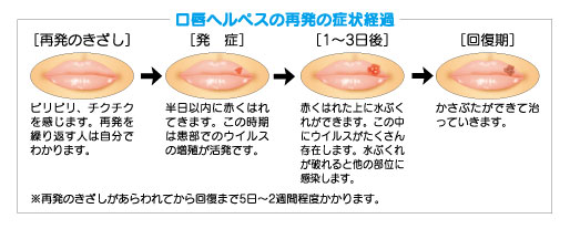 症状経過