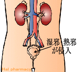 膀胱湿熱（泌尿器・生殖器炎症、結石）