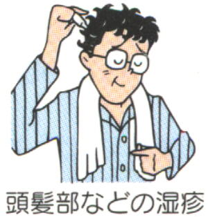 頭髪部などの湿疹