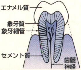 なぜ歯がしみるのでしょう？