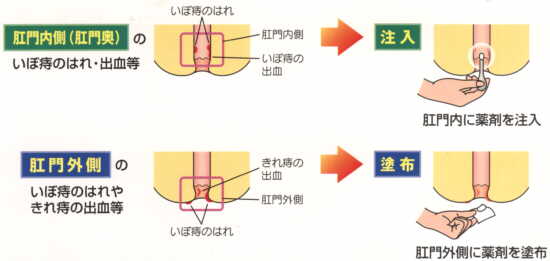 選べる2通りの使用法