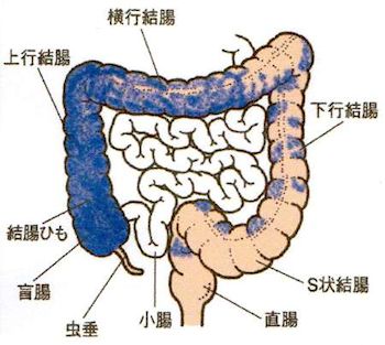 罹患部位