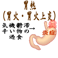 胃熱（胃火・胃火上炎）