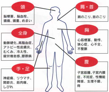 代表的な疾病