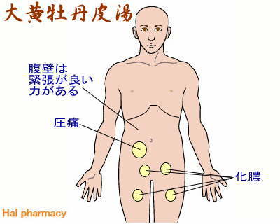 大黄牡丹皮湯