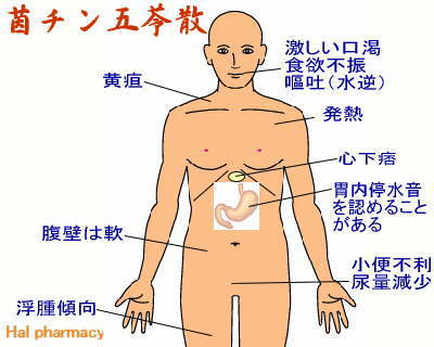 茵蔯五苓散