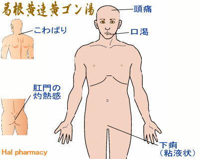 葛根黄連黄芩湯