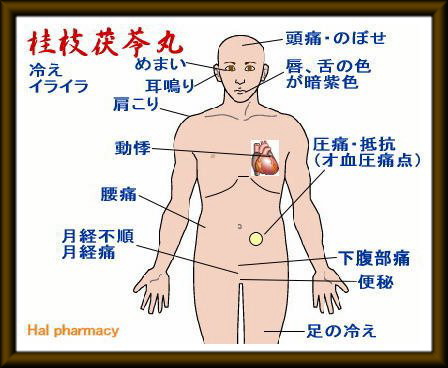 桂枝茯苓丸