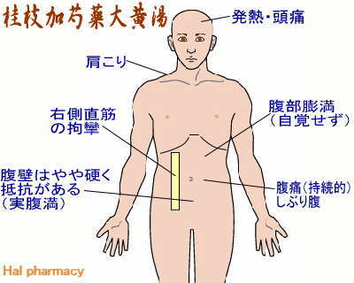 桂枝加芍薬大黄湯