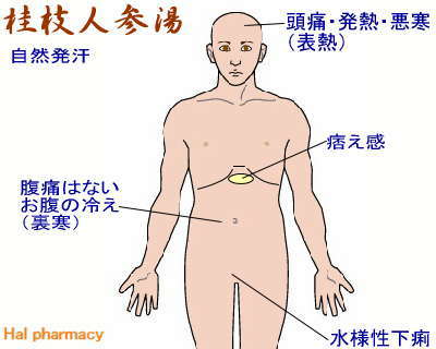 桂枝人参湯