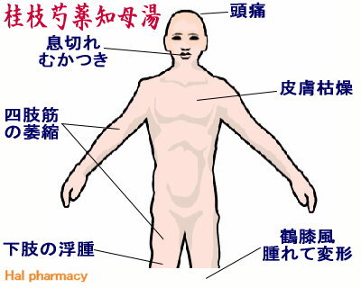 桂枝芍薬知母湯