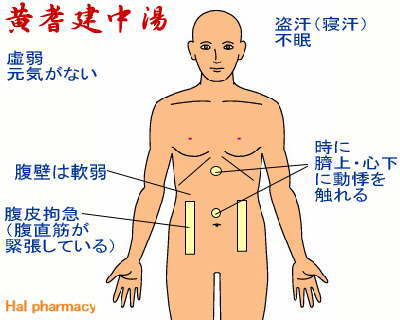 黄耆建中湯