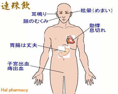 連珠飲(四物湯＋苓桂朮甘湯)