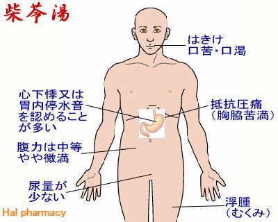 柴苓湯（小柴胡湯＋五苓散）