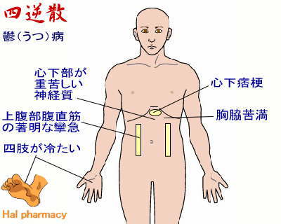 四逆散